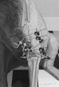 orthopedic surgery diagram